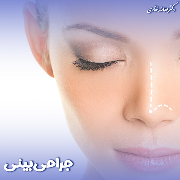 جراحی بینی - دکتر غفاری