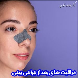 مراقبت های بعد از جراحی بینی - دکتر عطاالله غفاری