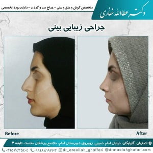 جراح بینی گلپایگان