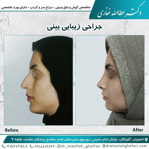 جراح بینی گلپایگان