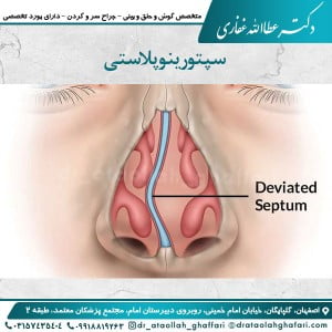 سپتورینوپلاستی