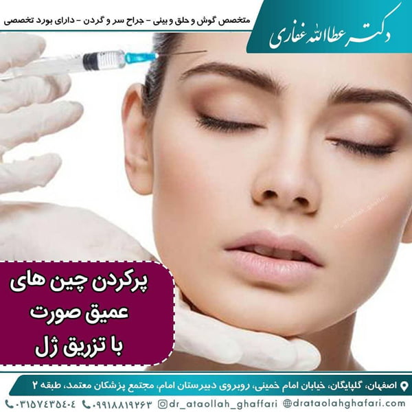 تزریق ژل
