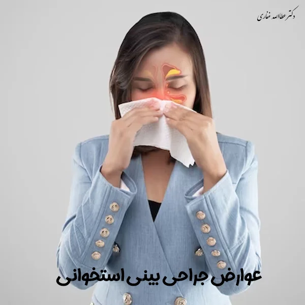 جراحی بینی استخوانی - دکتر غفاری